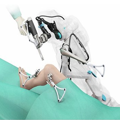Robotic knee replacement