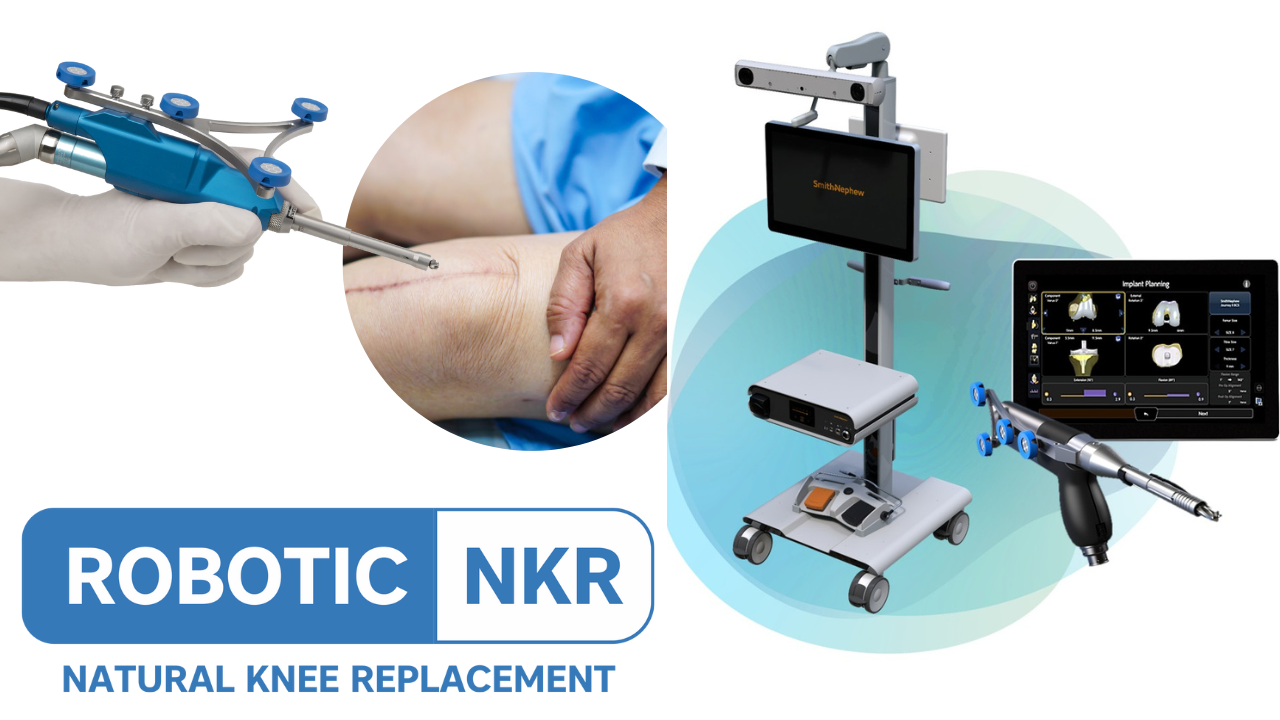 Robotic knee replacement